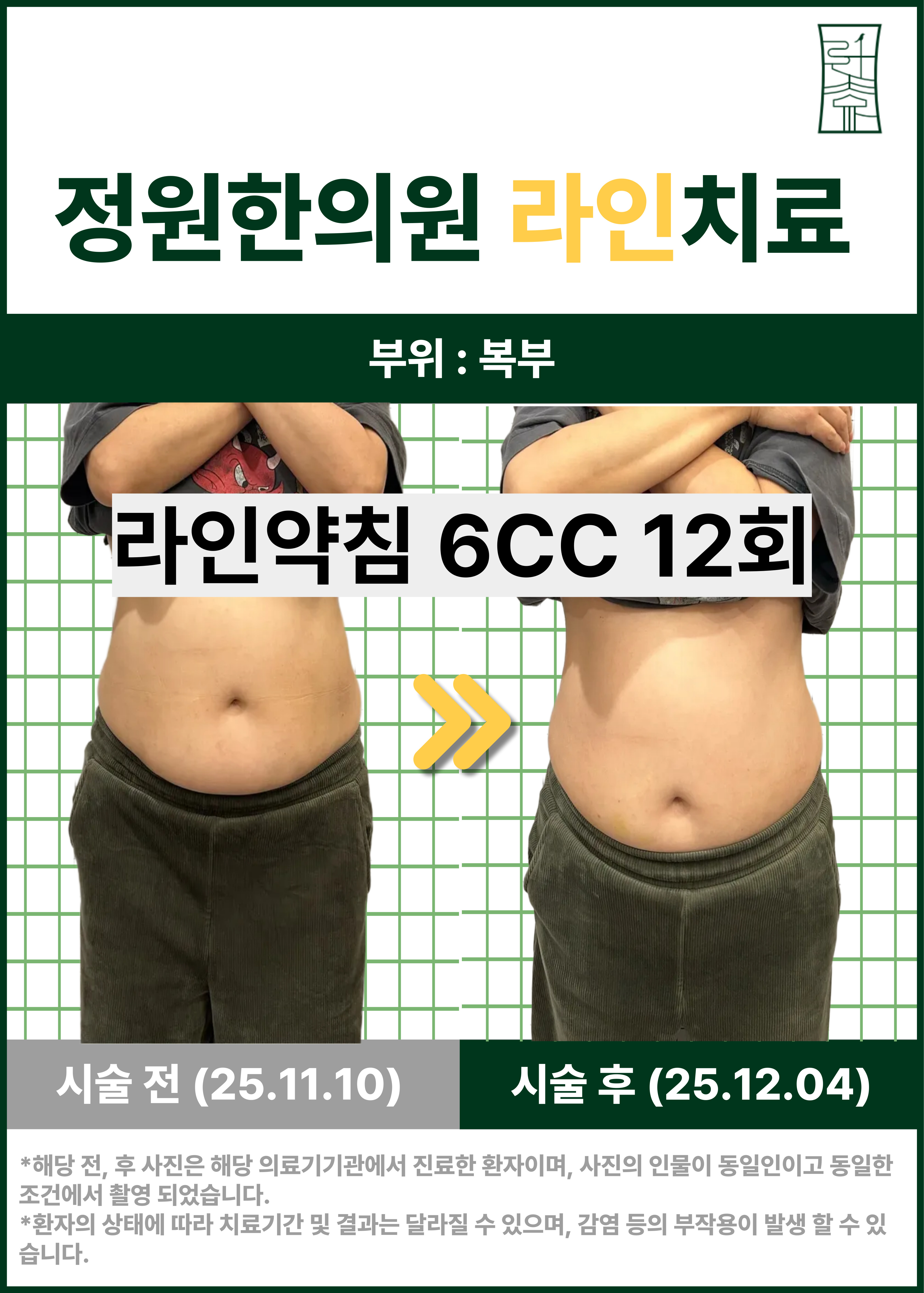 치료 전