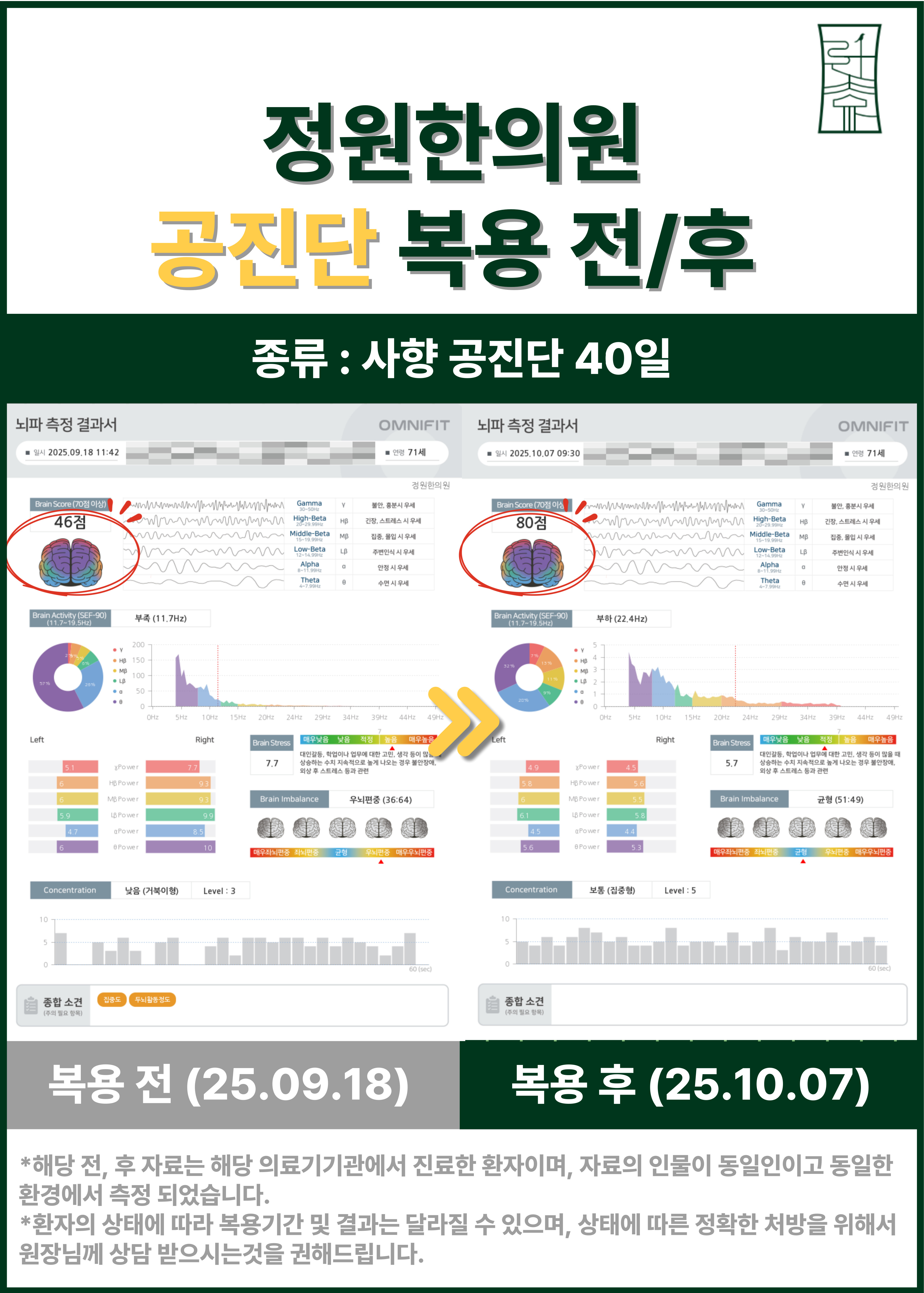치료 전