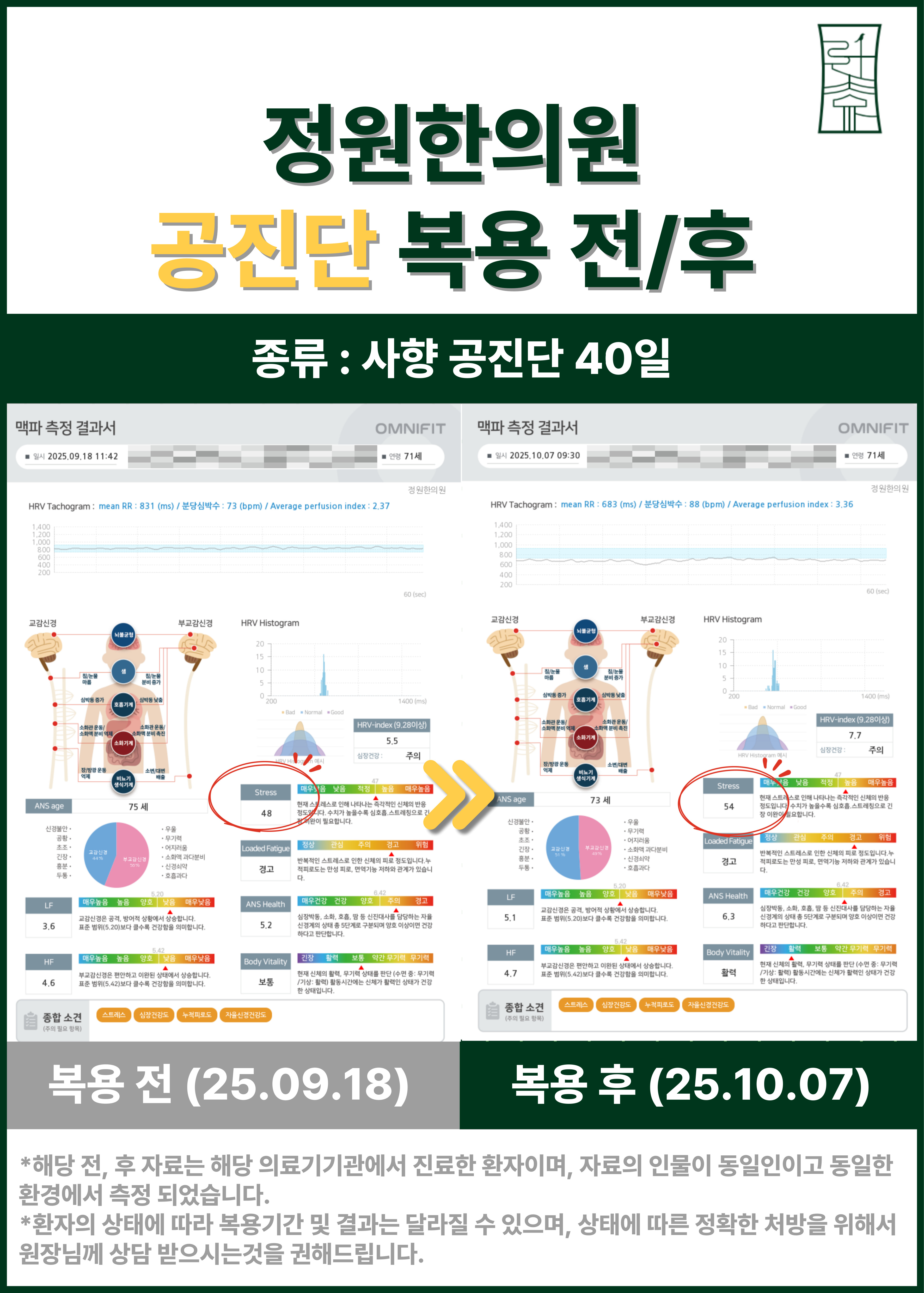 치료 전