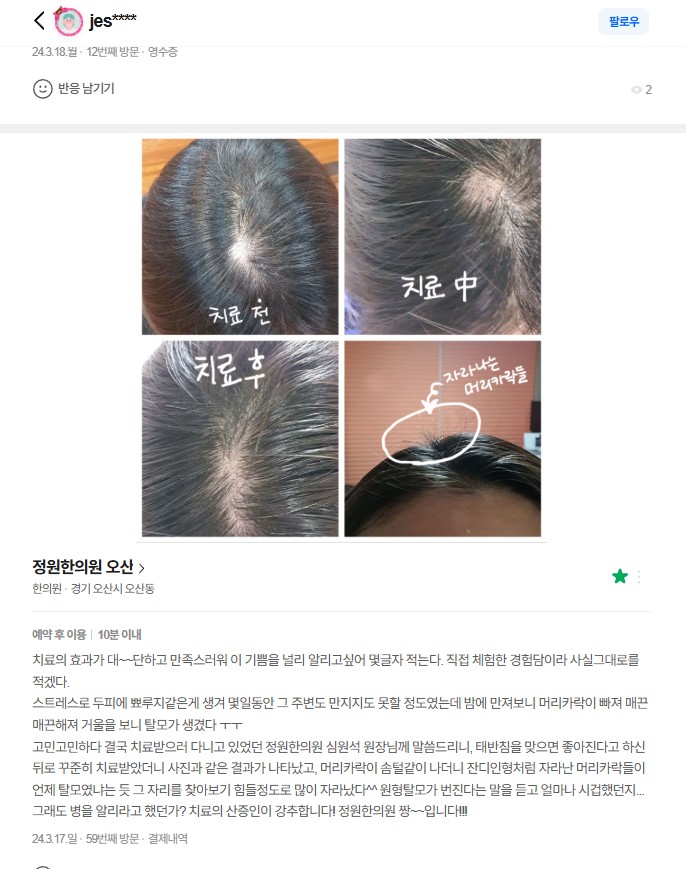 치료 전