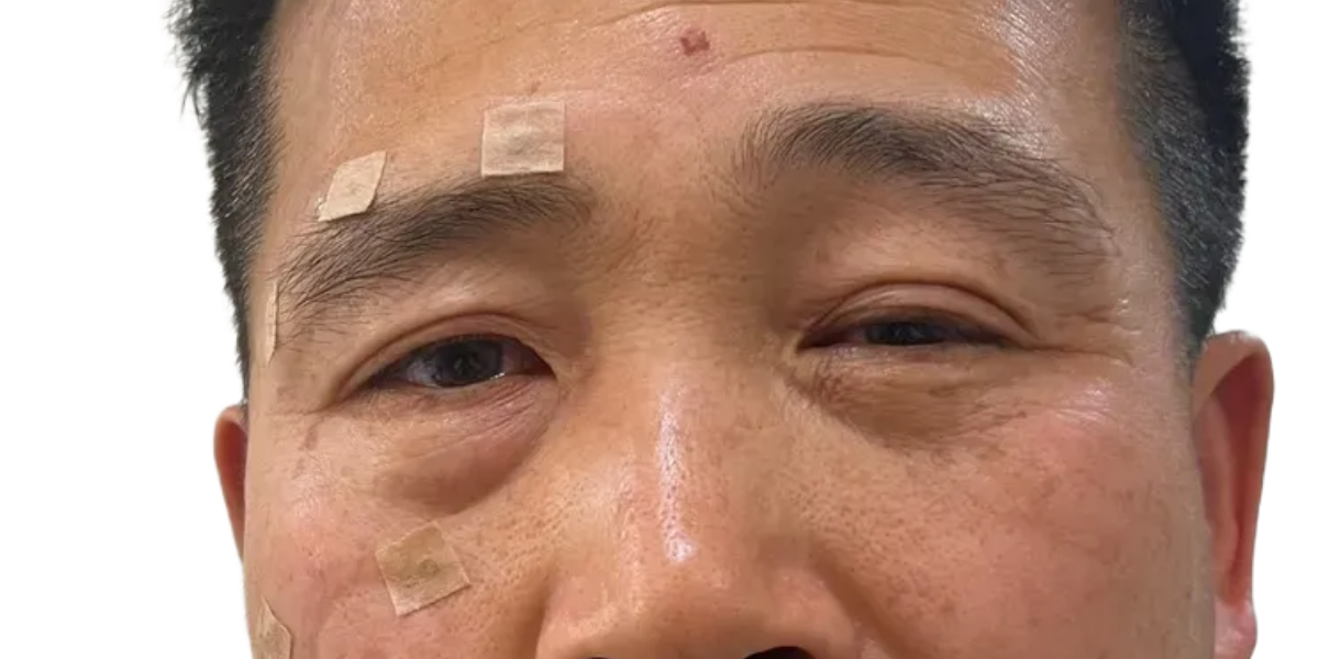 치료 전