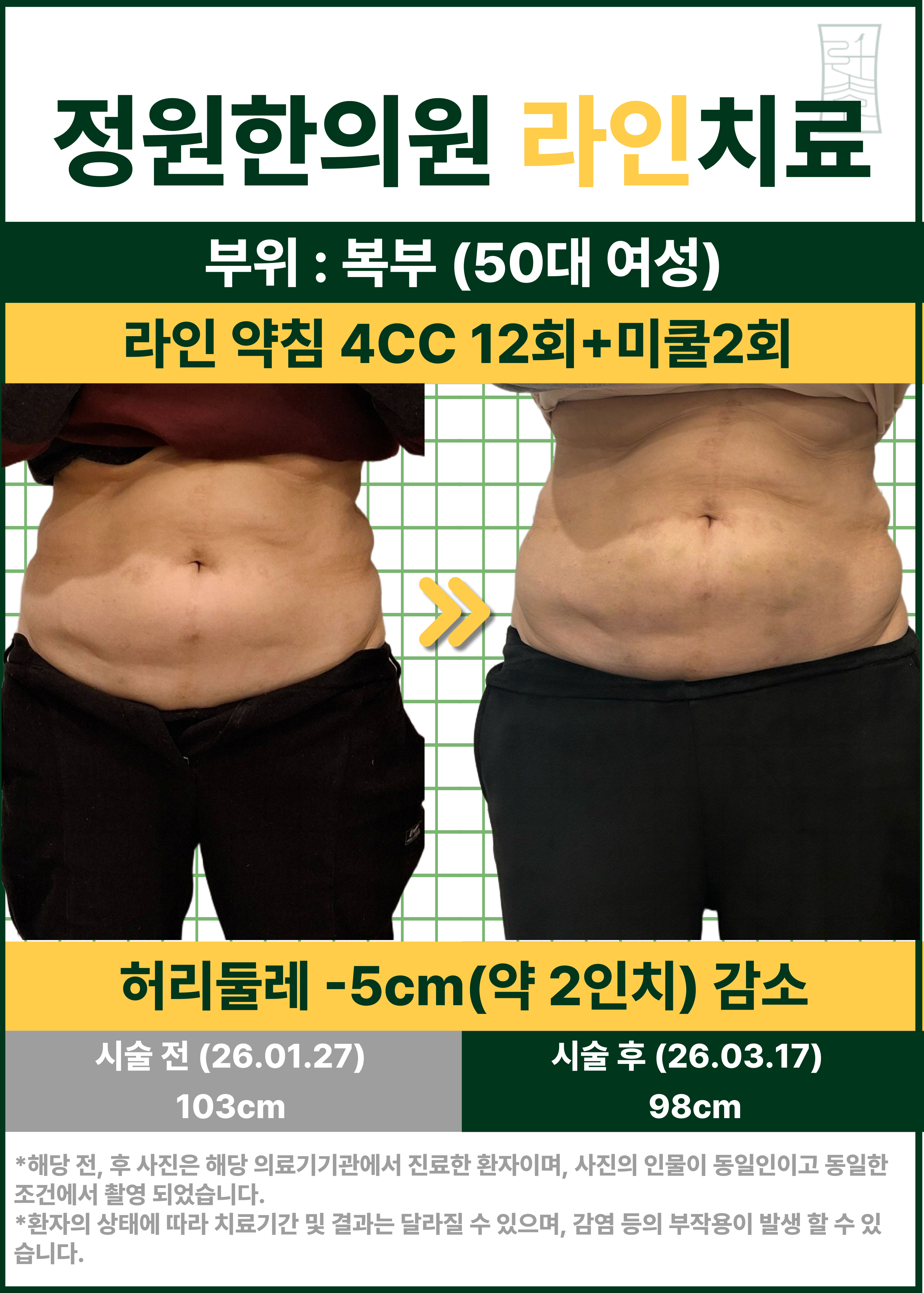 치료 전